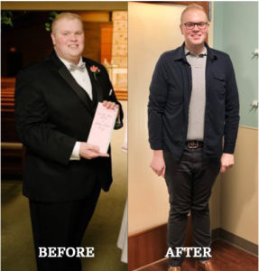 Before & After Bariatric Surgery Chicago | Success Stories | Dr. Lutfi